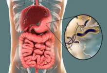 خوراکی‌هایی برای نابودی میکروب معده