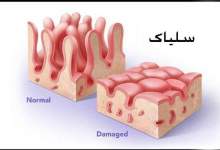 چند بیمار سلیاکی در کهگیلویه و بویراحمد شناسایی شد؟